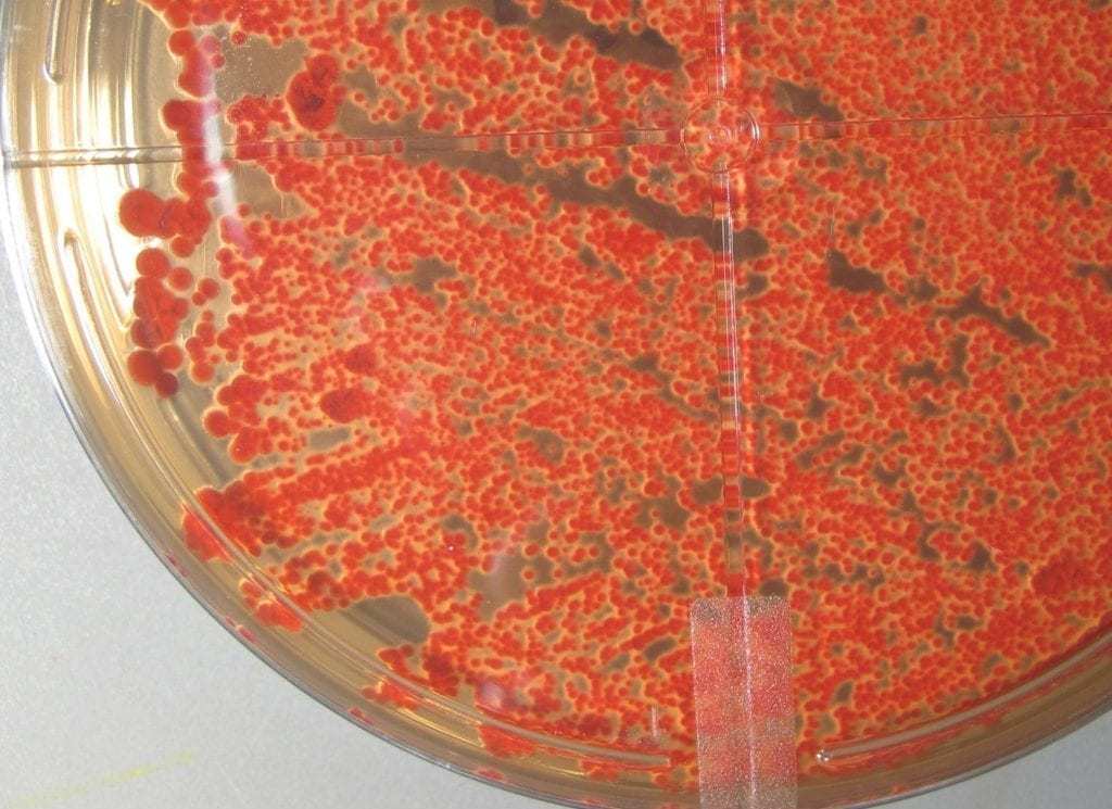 导致乙烯基和泡棉上出现粉红色污渍的细菌